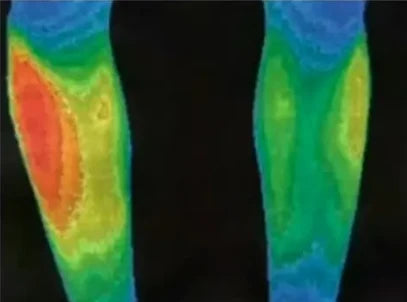 Before grounding – Knee region